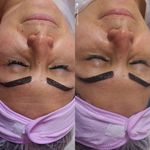 خدمات فیشیال و پوست مریم علا