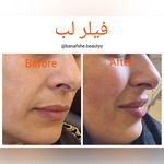 مطب پوست و زیبایی و لیزر بنفشه