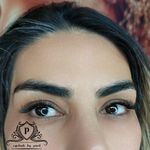 کاشت مژه(پریسا)