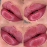 کلینیک زیبایی ،لیزر و لاغری گل مریم