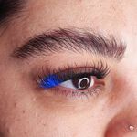 میکروبلیدینگ راحیل