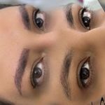 Micro_mahsa  میکروبلیدینگ فیبروز