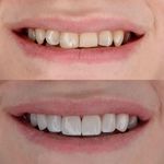 دندانپزشکی و ایمپلنت دکتر مهدی کریمی
