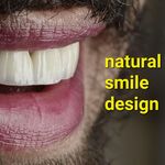دندانپزشکی و ایمپلنت دکتر مهدی کریمی