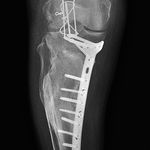 هِلثـــی | خدمات پزشکی و پرستاری در منزل