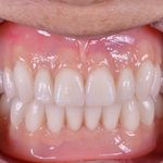 دندانسازی دیجیتال میلاد مشیری