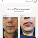 مجموعه زیبایی و لیزر پردیس مارال/مطب دکتر مرضیه پوراکبری