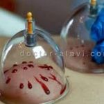 حجامت استاد حمیدی