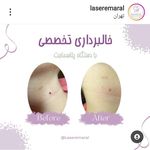 مجموعه زیبایی و لیزر پردیس مارال/مطب دکتر مرضیه پوراکبری