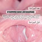 آکادمی فرهمند ترمیم بکارت تهران و تبریز
