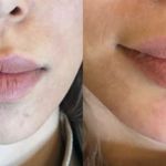 مرکز لیزرو کلینیک زیبایی طراوت