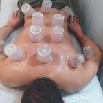 حجامت، زالو درمانی، فصدخون.برداشتن خال امجدیان