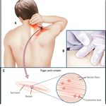 فیزیوتراپی عیوضی