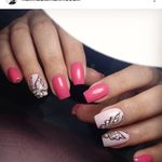 مرکز کاشت ناخن حدیث