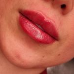 کلینیک زیبایی و لیزر آرورا