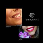 دندانپزشکی تبسم