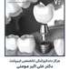دندانپزشکی ایمپلنت دکتر علی اکبر مومنی