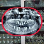 دندانپزشکی و ایمپلنت یونا