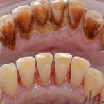 دندانپزشکی و ایمپلنت یونا