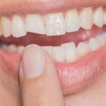 دندانپزشکی و ایمپلنت یونا
