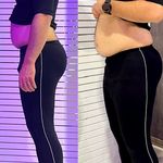 مرکز لاغری موضعی و ایکس بادی فیت اسمارت