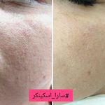 فیشال تخصصی و پاکسازی