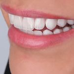 دندانپزشکی دکتر بیتا مدبّر