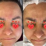 پاکسازی و فیشال لی لی