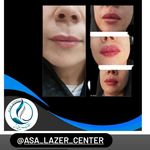 مرکزکلینیک لیزر زیبایی پوست و مو آسا
