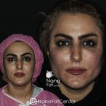 مطب پوست مو لیزر و زیبایی لارا