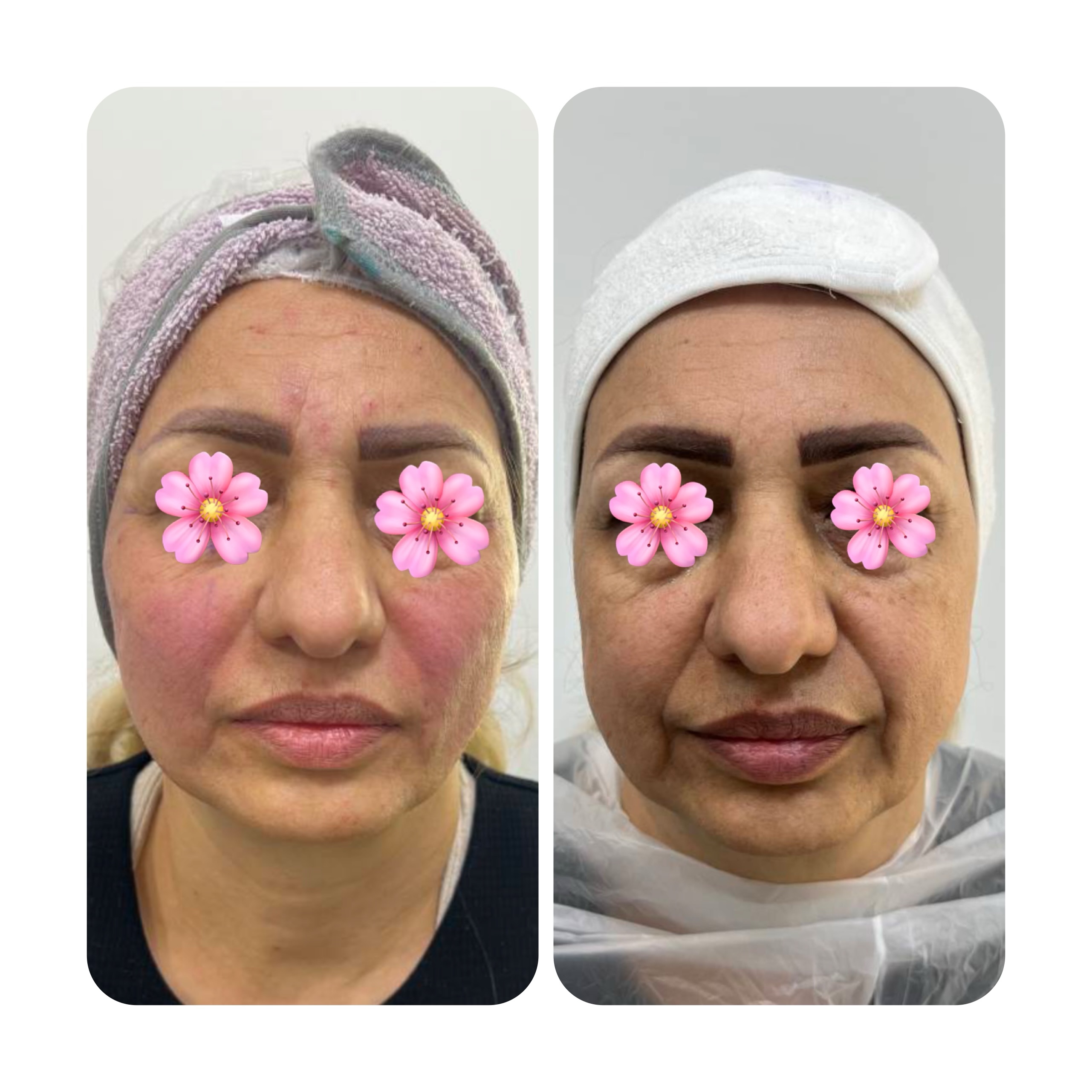 کلینیک زیبایی هانا