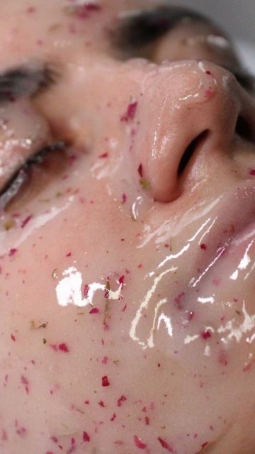 خدمات تخصصی هیدرو فیشال صورت نومه لوکس