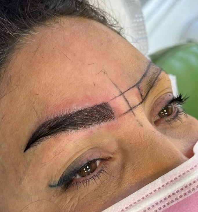 کاشت ابرو طبیعی شیبانی