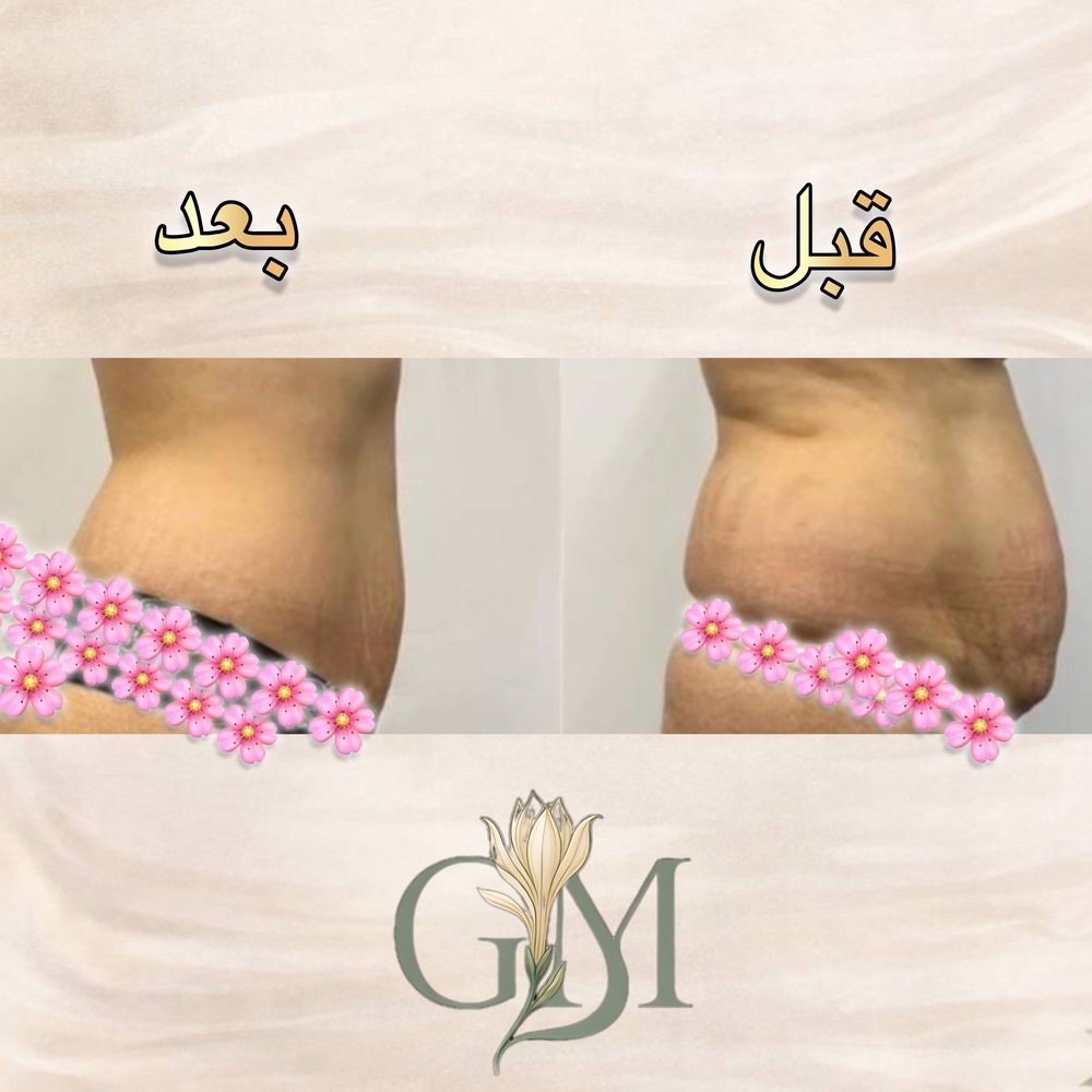 مرکز تخصصی لاغری گل مریم