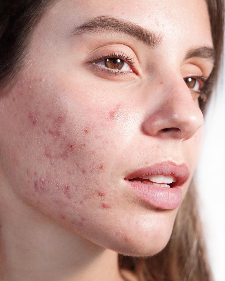 آرایشی بهداشتی درمانی باقری