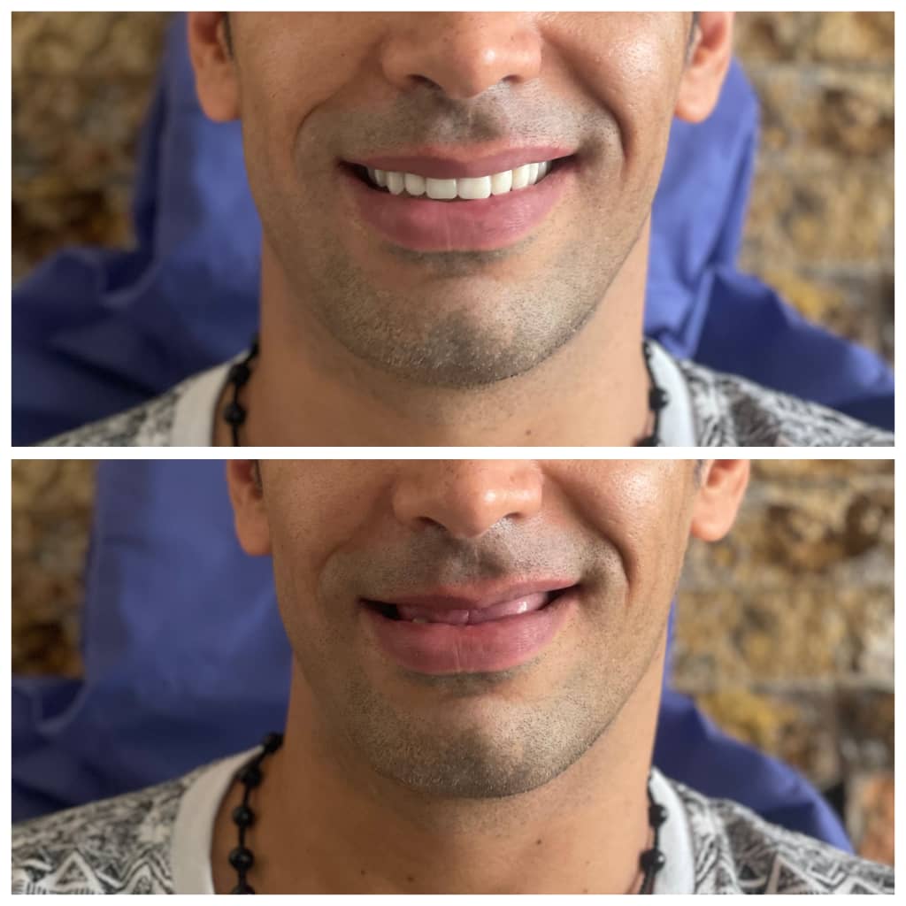 مجموعه دندان پزشکی و دندان سازی نچرال