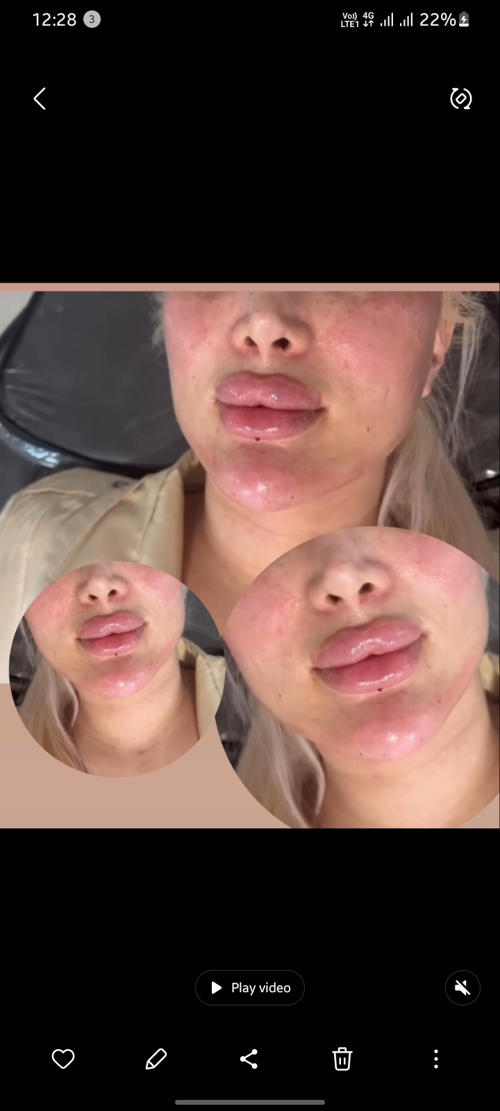 تزریقات زیبایی حدیث