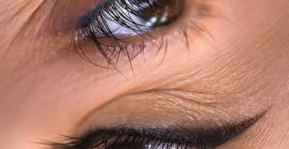 میکروبلیدینگ رامونا