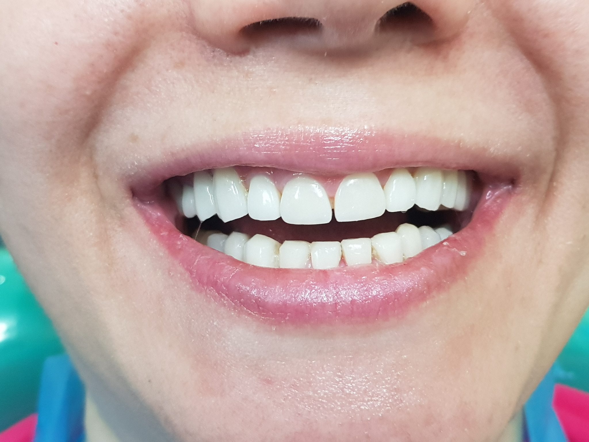 دندانپزشکی ترمیمی  زیبایی دکتر شیخ رضایی