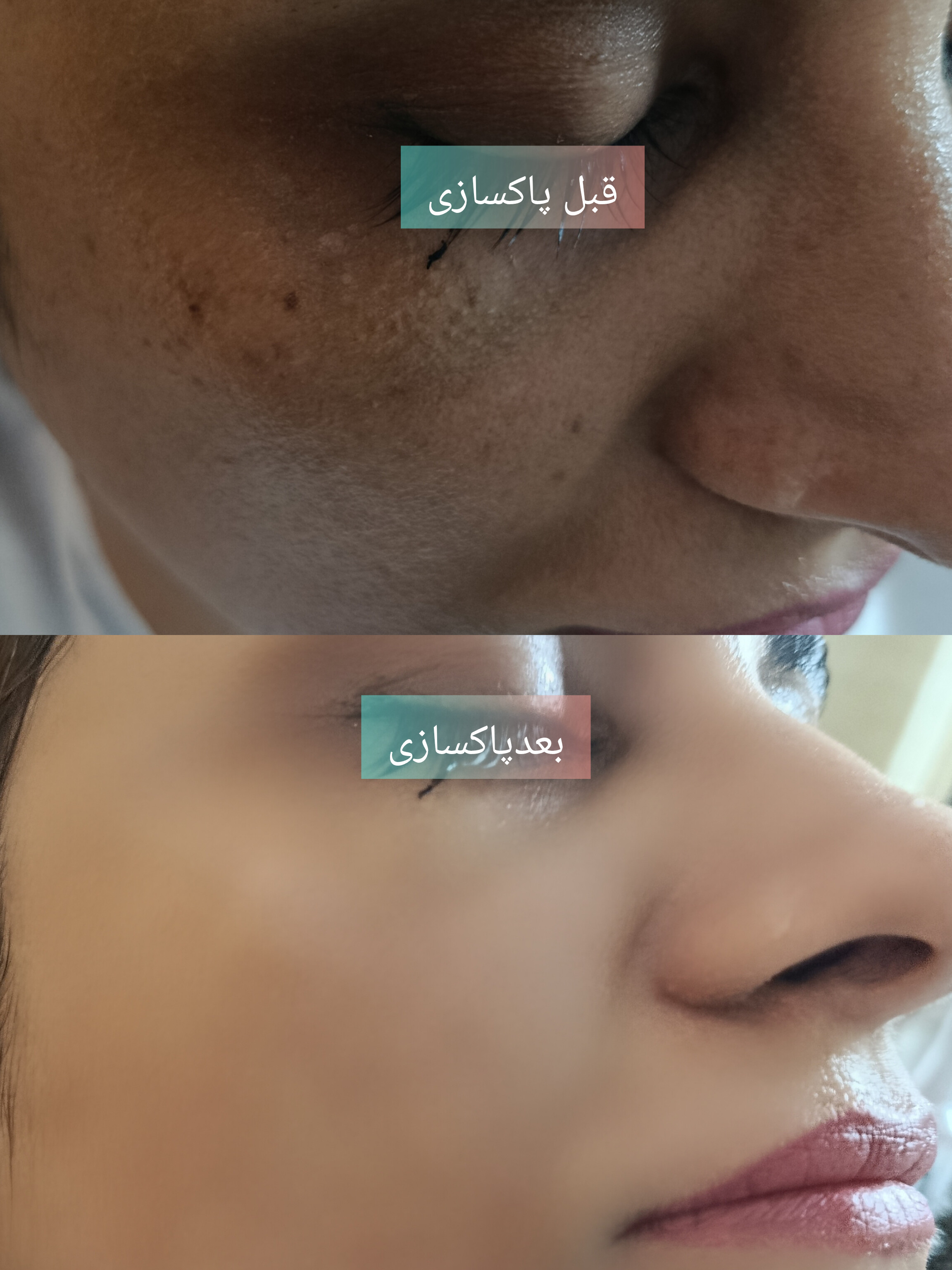 آرایشگری پاکسازی
