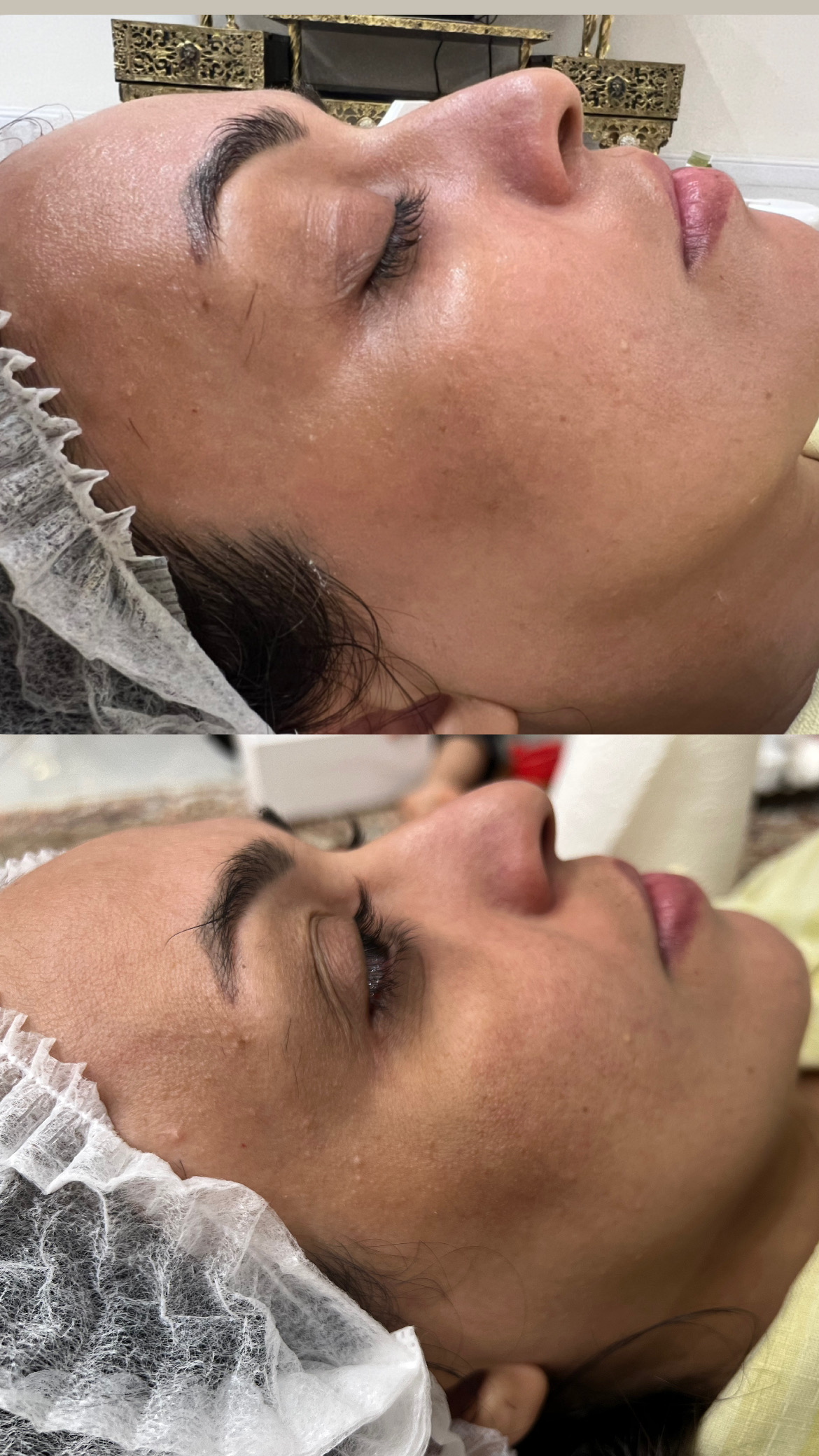 خدمات تخصصي پوست و تيرگي هاي بدن محبوبه