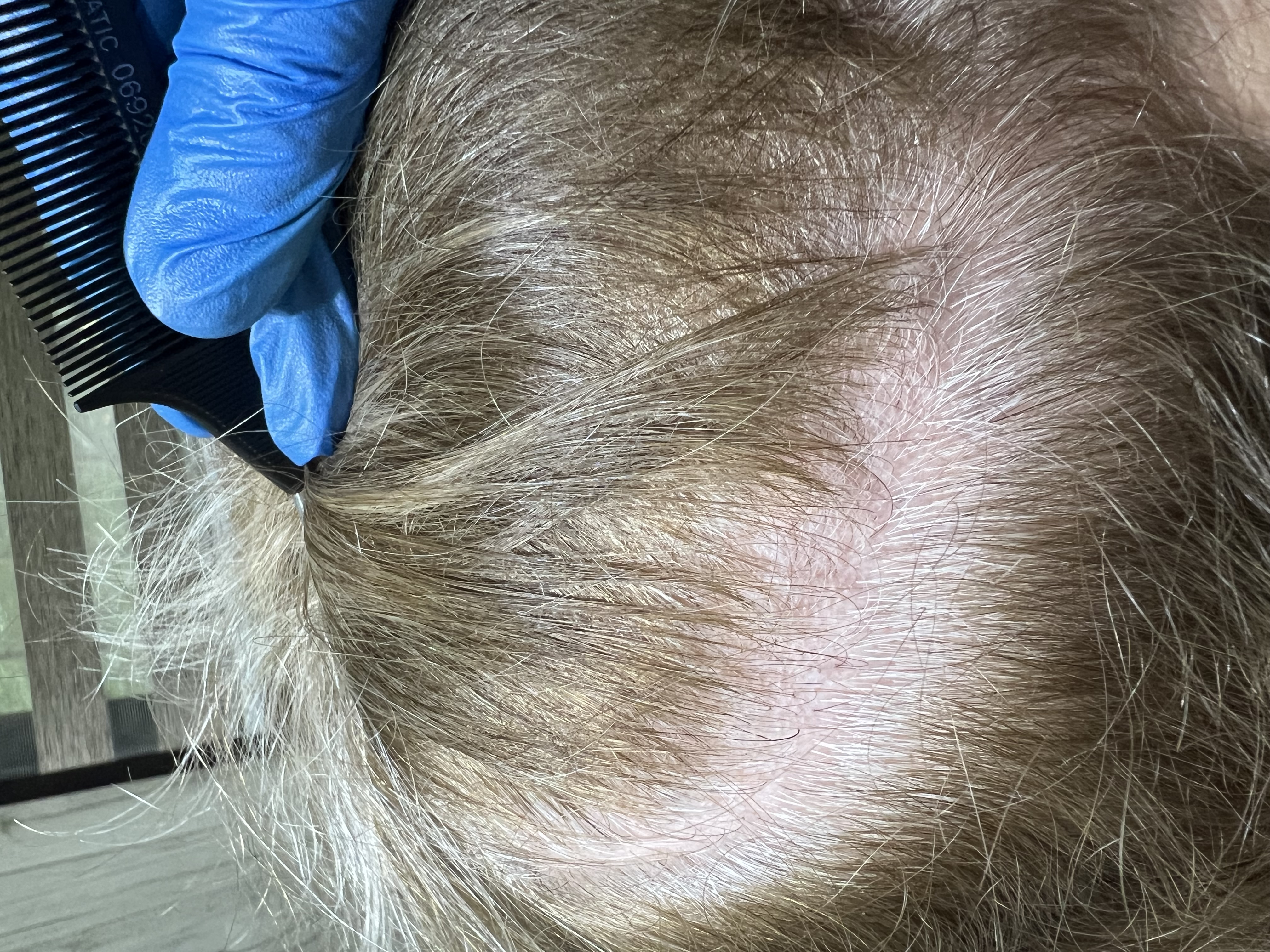 خدمات احياء مو رشیدی