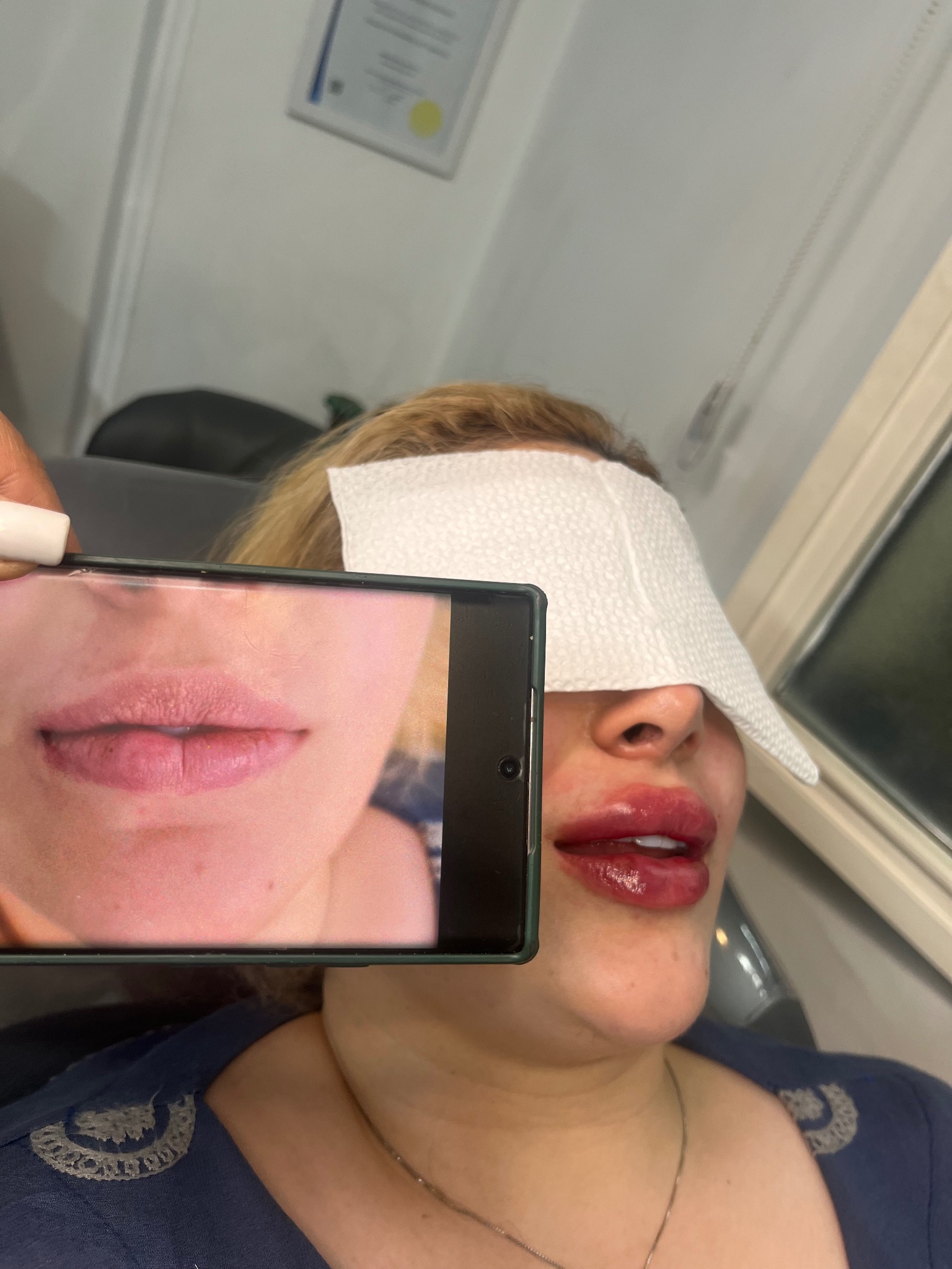 مطب پوست و مو و لیزر ژیوان