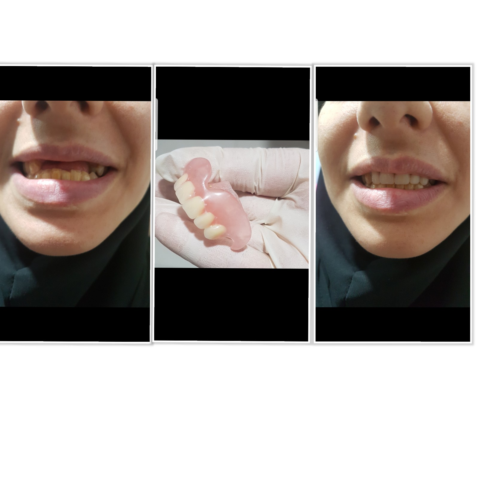 دندانپزشکی اقساطی یاس درپرند
