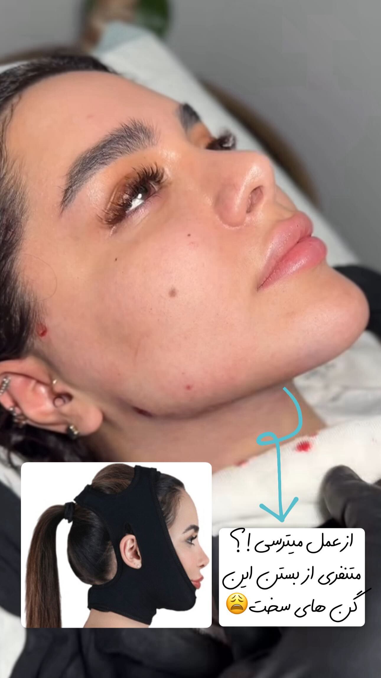 کلینیک تخصصی پوست و زیبایی ملینا