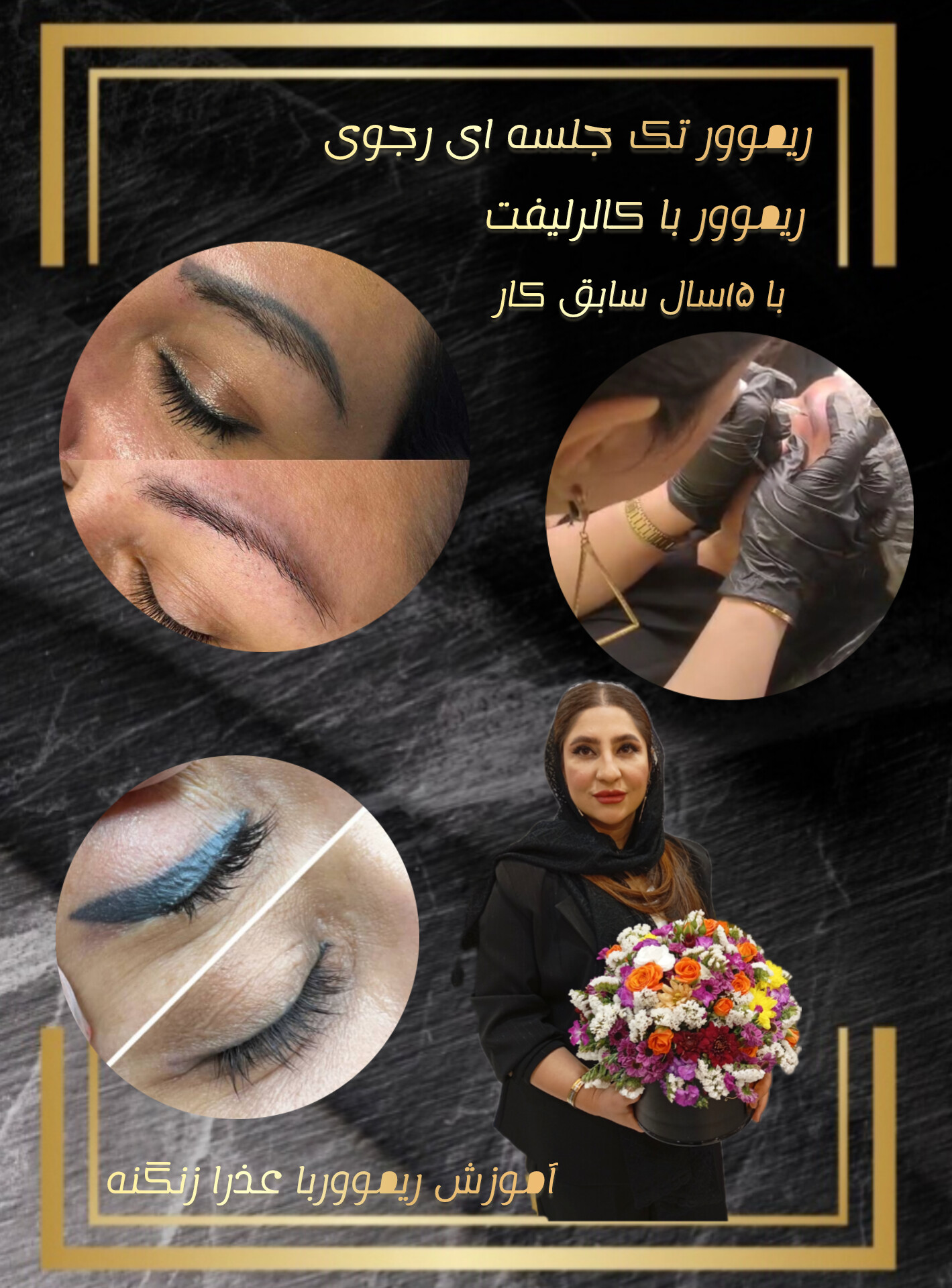 عذرا زنگنه ریموور تک جلسه ای