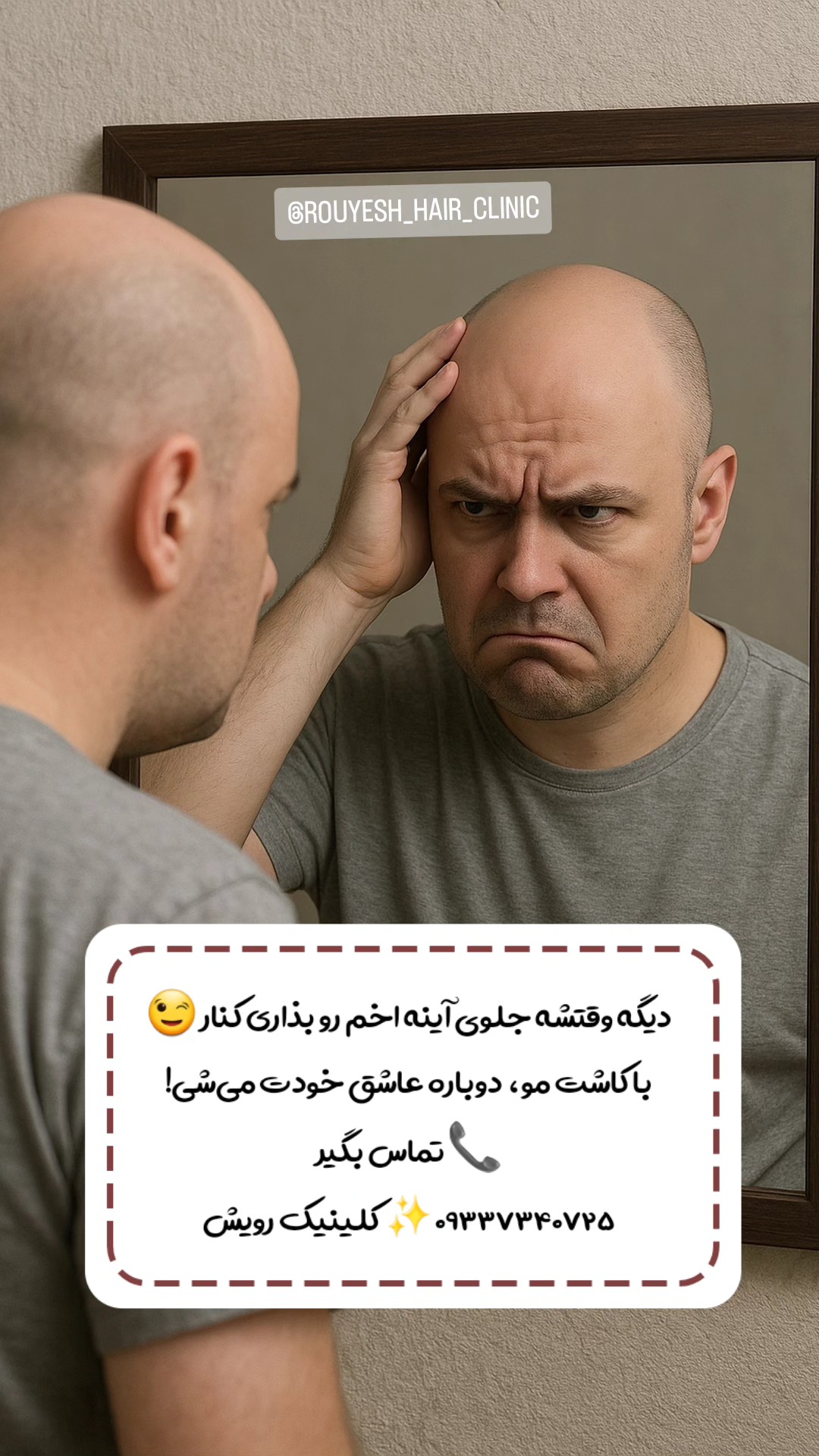 کلینیک کاشت مو رویش