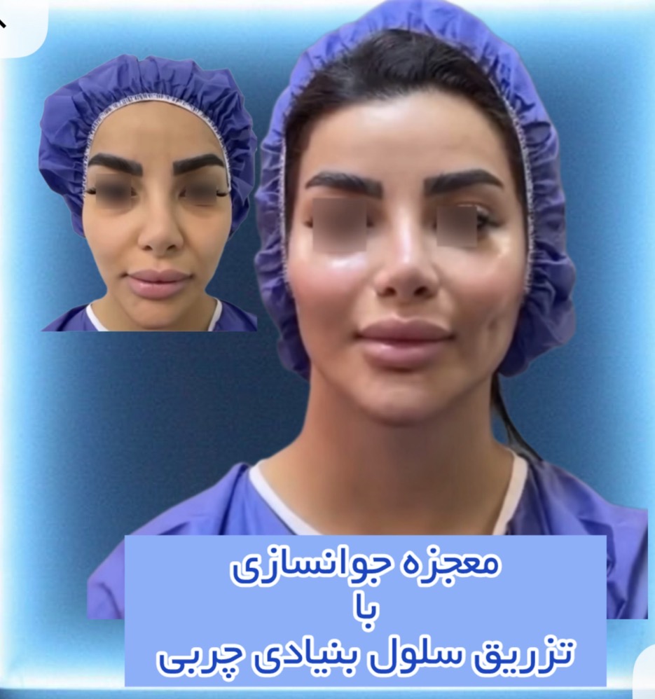 دکتر محمود قهقایی فوق تخصص جراحی پلاستیک