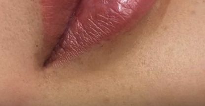 مرکز لیزر کلینیک زیبایی رزنیلای مرزداران