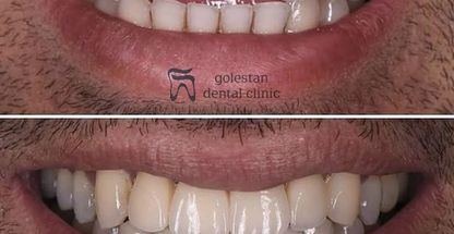 کلینیک دندانپزشکی شبانه روزی گلستان